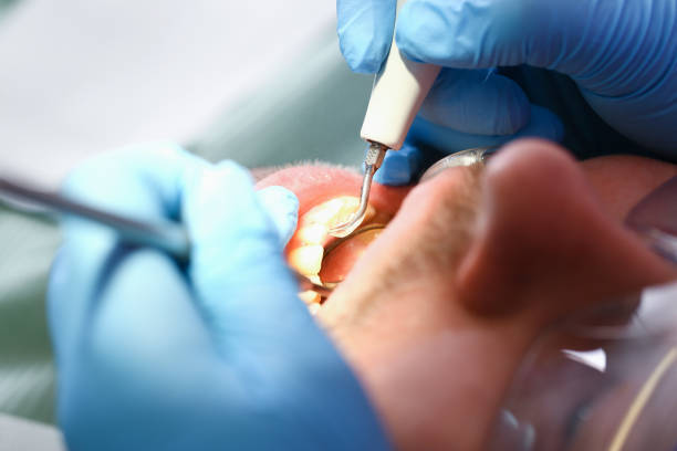 Best Emergency Care for Gum Disease in Iroquois Point, HI