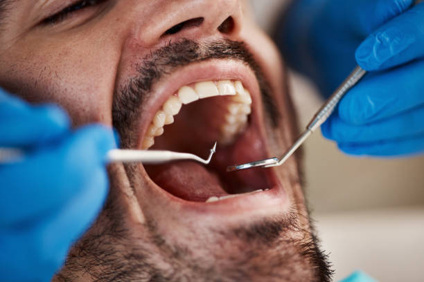Best Broken or Chipped Tooth Repair in Iroquois Point, HI